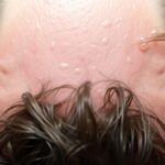 Co na przetłuszczające się włosy – jak ograniczyć nadmiar sebum Co na przetłuszczające się włosy