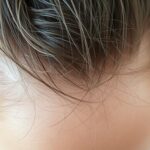 Co na wypadanie włosów u kobiet – przyczyny i skuteczne leczenie Co na wypadanie włosów u kobiet