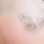 Ile odrastają włosy od łysego – kiedy widać pierwsze efekty Ile odrastają włosy od łysego